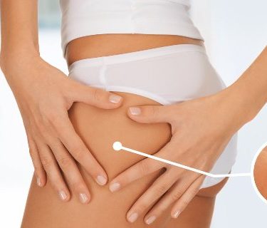 Endermologie Massage