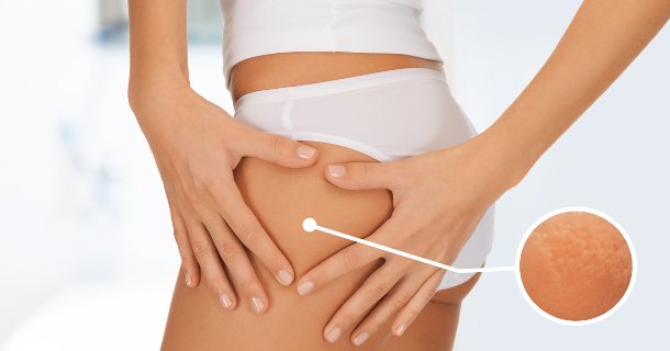 Endermologie Massage