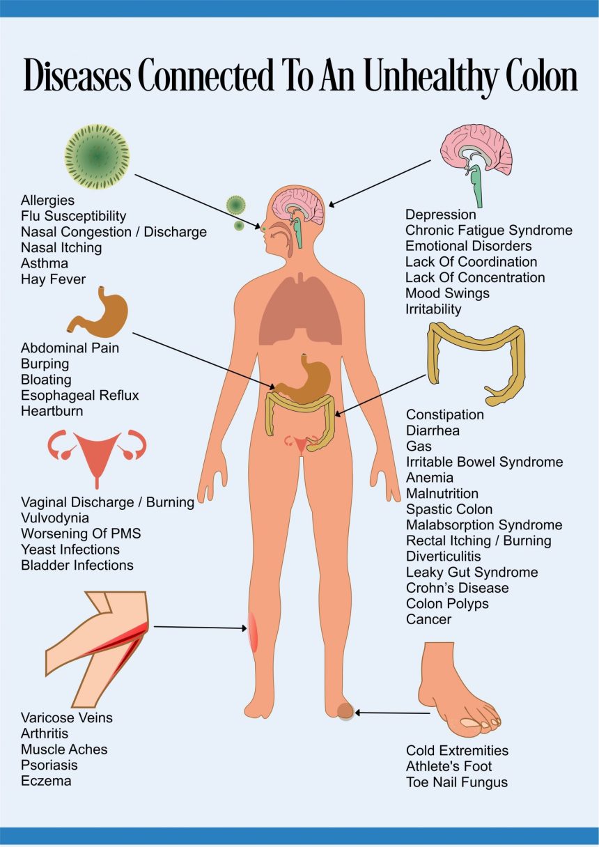 Diseases Connected to an Unhealthy Colon