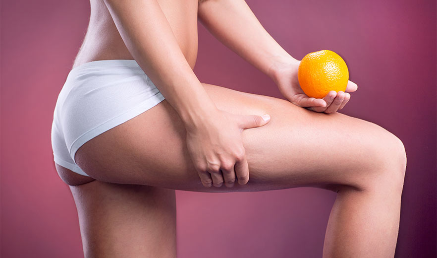 A woman in white shorts holds an orange against her thigh, symbolizing Lipomassage treatment for cellulite reduction.