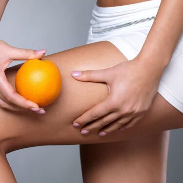 Woman holding an orange beside her thigh to illustrate the dimpled texture associated with cellulite.